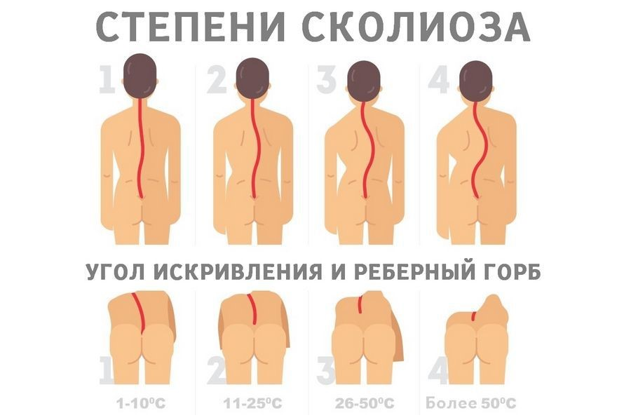 Рисуем Спину человека поэтапно для детей.