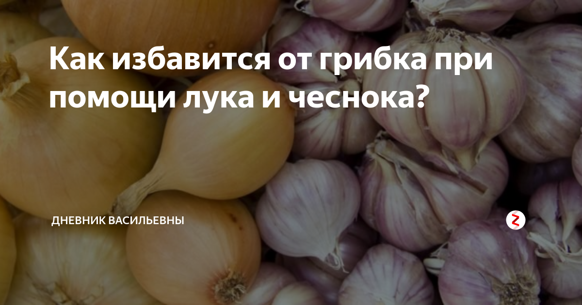 Дерматолог дал рекомендации по избавлению от грибка ногтей. Спорт-Экспресс