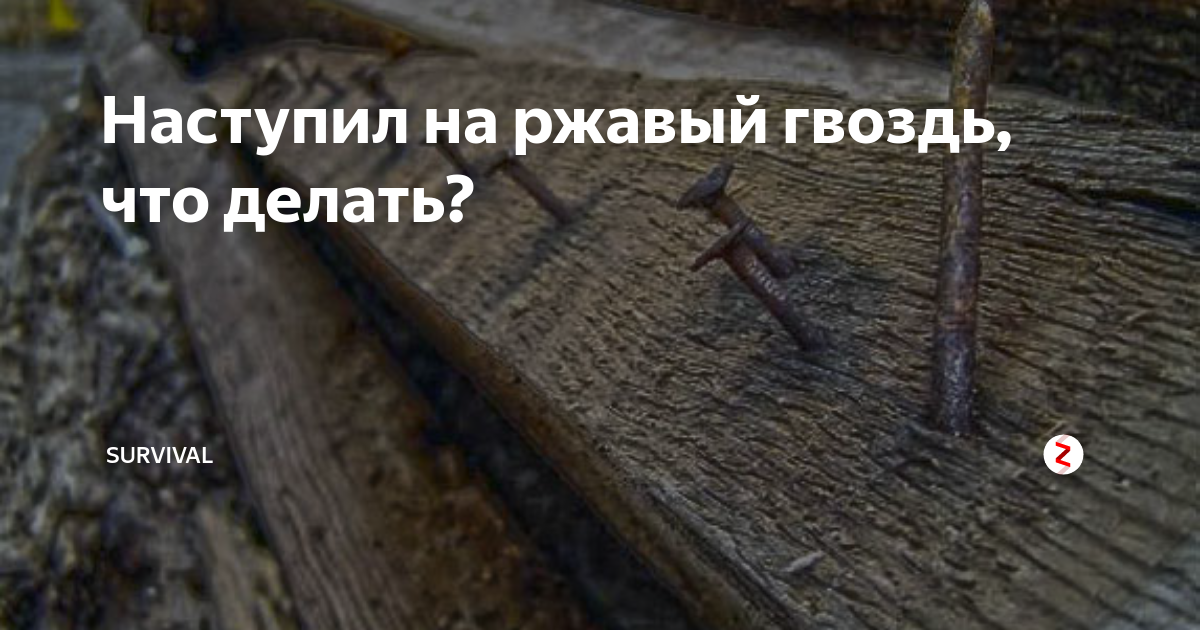 Ребенок порезался, наступил на гвоздь, сломал руку или ногу? | ДГКБ-9