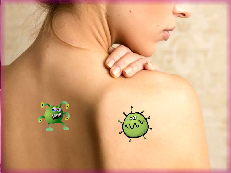 Лечение угревой сыпи. 