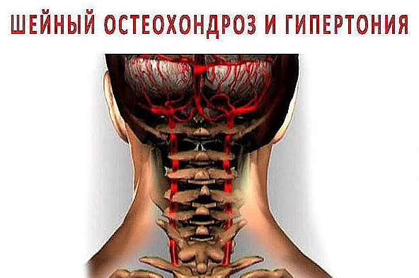 Шейный остеохондроз – причины, симптомы и лечение в клинике Семейный доктор в Москве