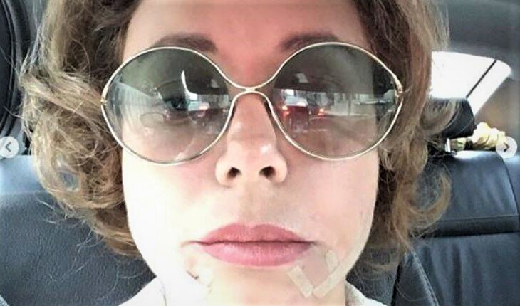 Фотография сразу после операции