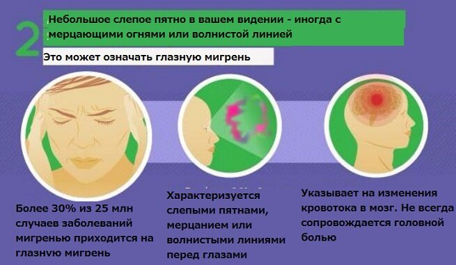 Признаки глазной мигрени с мерцательной скотомой: