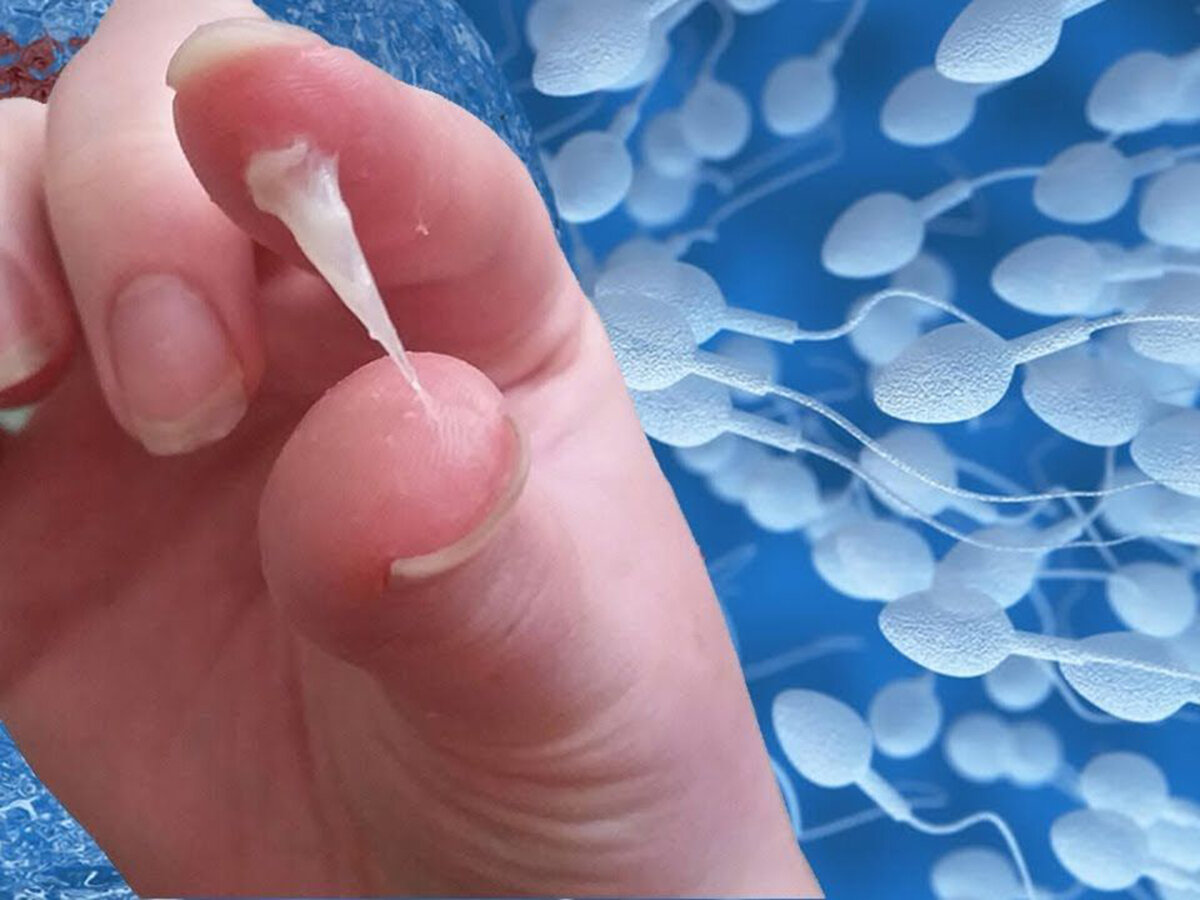 Что влияет на качество спермы? | ПульсПлюс | Дзен