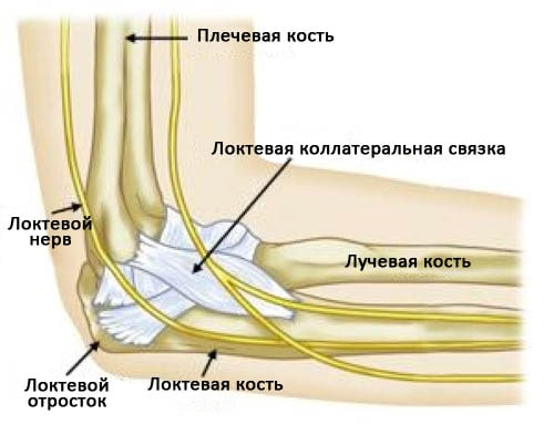 Эпикондилит плечевой кости