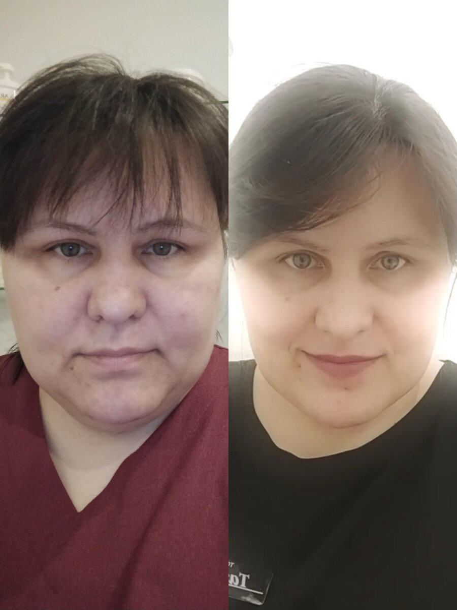 Фото слева-октябрь 2021 года. Мой вес-140 кг. Нет, я не с бодуна, не пью спиртное) Фото справа-сделала сегодня на работе. Вес сегодня-114,4 кг.  Коллаж для самомотивации) 