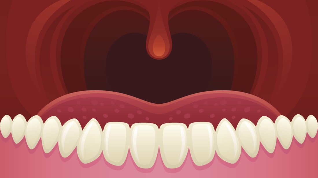     Латинское название этого органа — uvula. Отсюда понятие «увулярные согласные» — согласные звуки, образуемые в районе небного язычка.