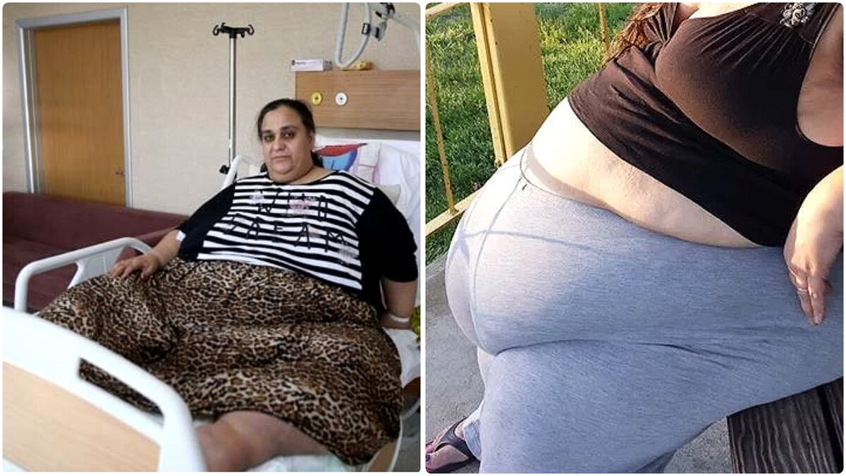 Самая толстая женщина в мире (17 фотографий) » Невседома