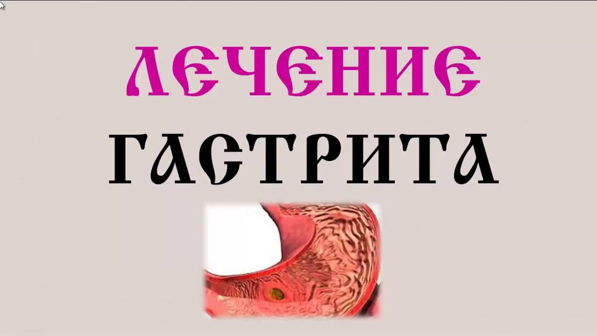 Можно ли пить кофе при гастрите, язвах желудка и двенадцатиперстной кишки?