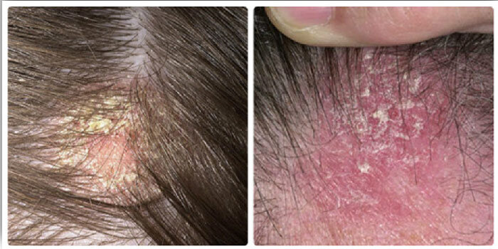 Источник google images