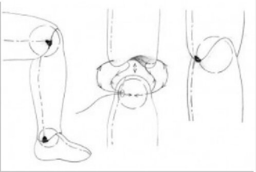 Соединение через скрытую бусину. 