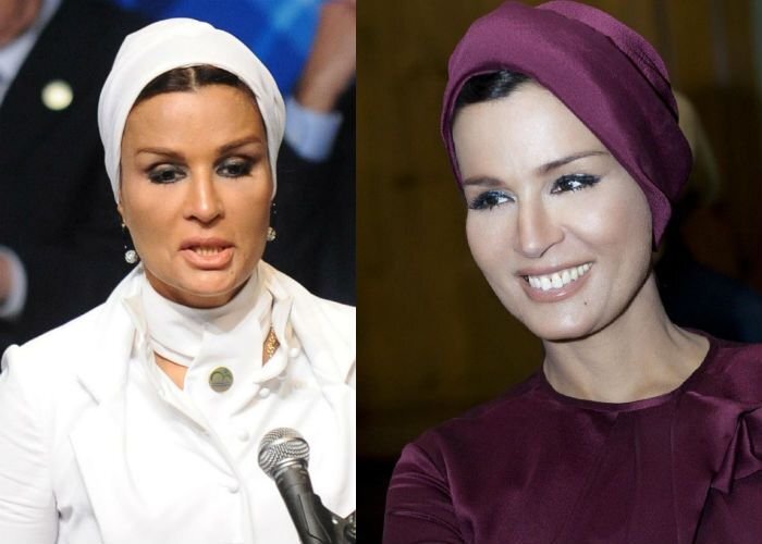 Шейха моза до и после пластики