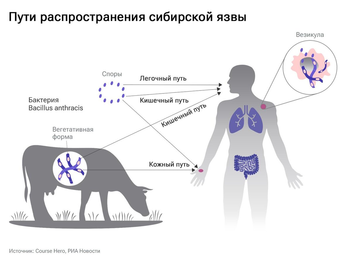    Инфографика