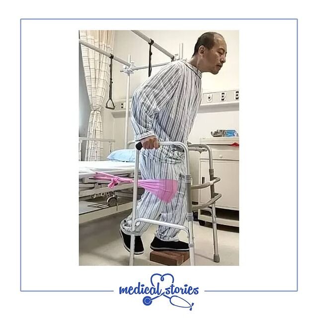    Ли Хуан делает первые шагиФото: medics.stories