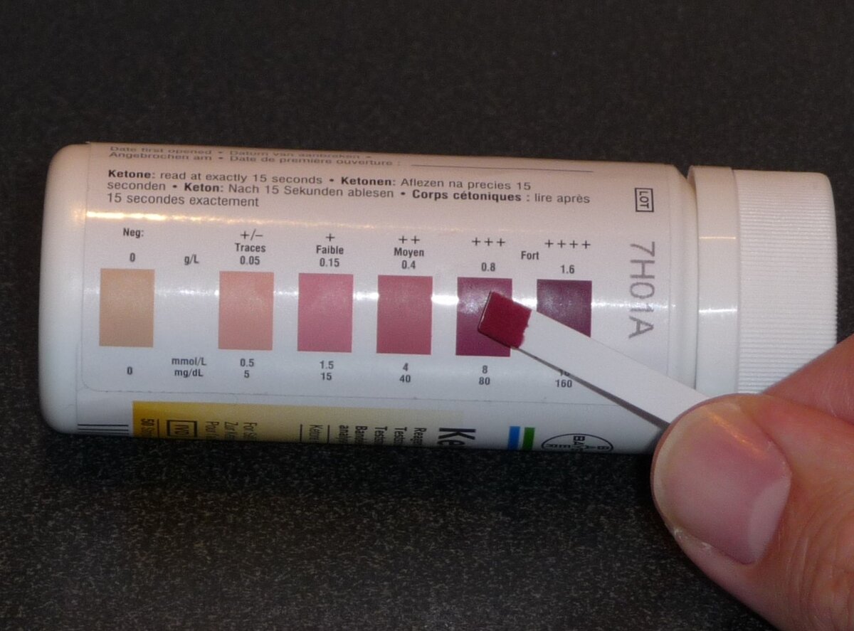 Диабетический кетоацидоз картинки