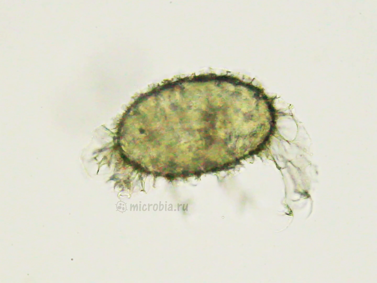 Циста пресноводной тихоходки. Виден глазик. 