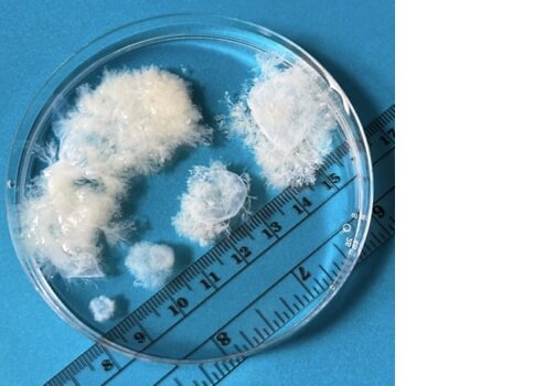 Рисунок 1. Ткань эмбриона на сроке беременности женщины от 5 до 9 недель