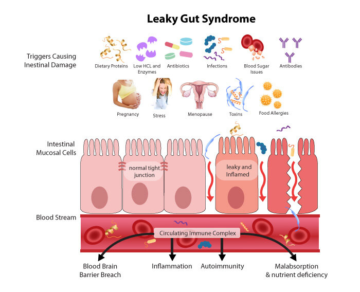 Leaky Gut = означает протекающая кишка