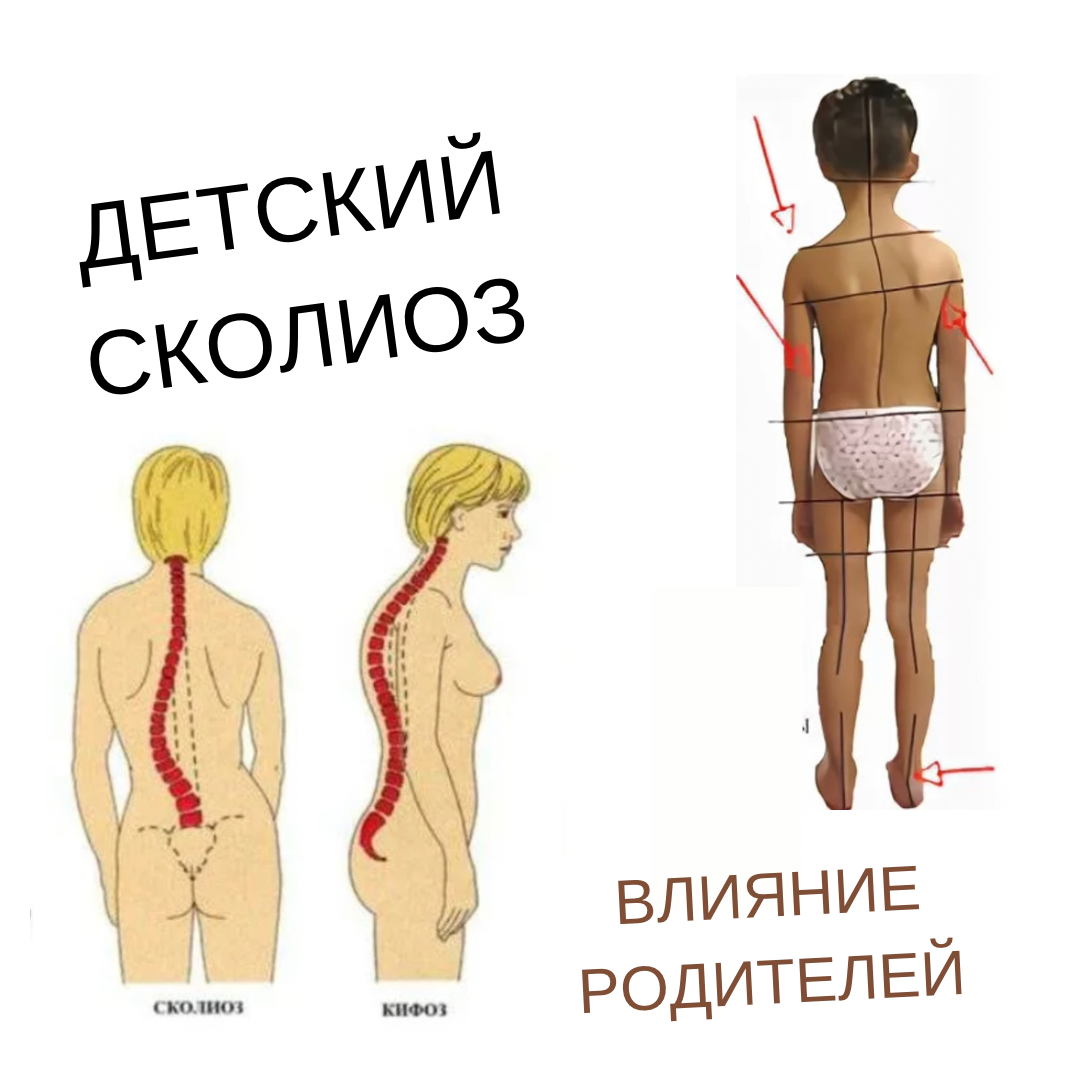 Боль в области поясницы лечение, причины, симптомы, защемление нерва клинка в Мо