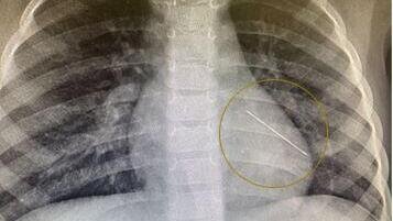 ФОТО: из общедоступных источников