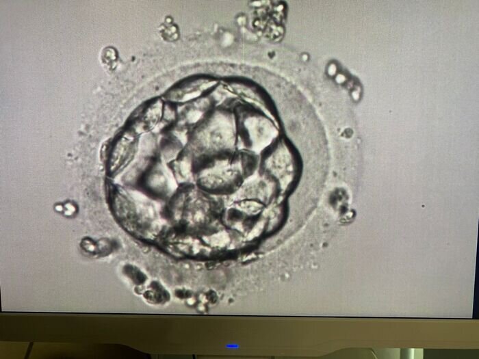 Криоперенос: размораживание и перенос эмбрионов цена в Краснодаре | Клиника Эмбрио