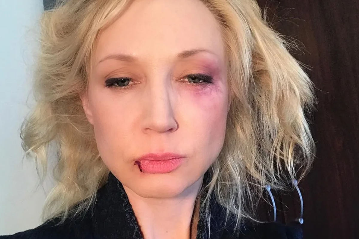 Кристина орбакайте без макияжа. Кристина орбакайте сейчас. Кристина орбакайте сейчас. Что случилось с орбакайте кристиной последние. Кристина орбакайте сейчас.