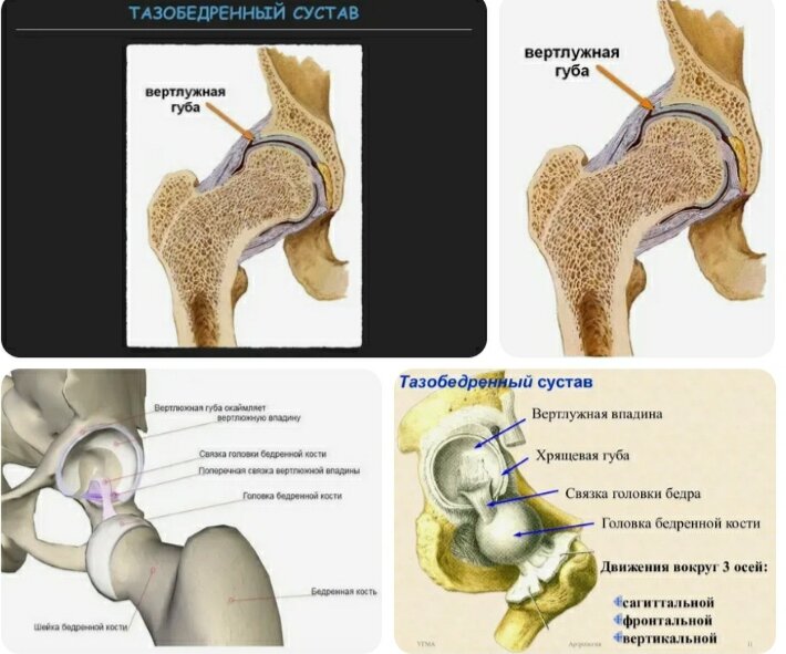 Патологии суставной губы тазобедренного сустава — Physiotherapist