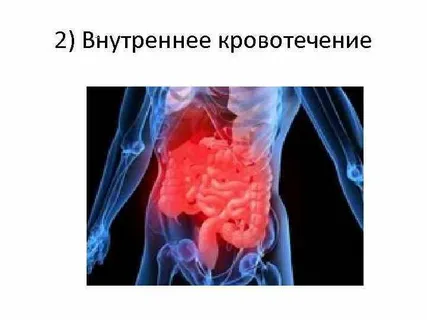 взято из общего доступа