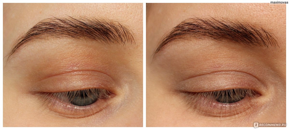                                                                   ДО    И      ПОСЛЕ НАНЕСЕНИЯ БАЗЫ.