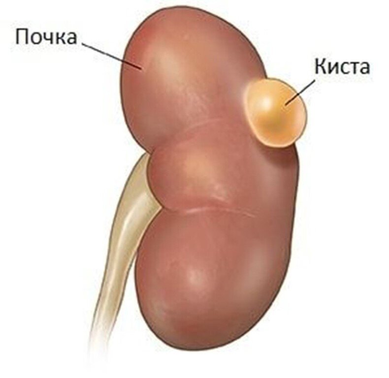 Как распознать болезни почек? Симптомы и лечение