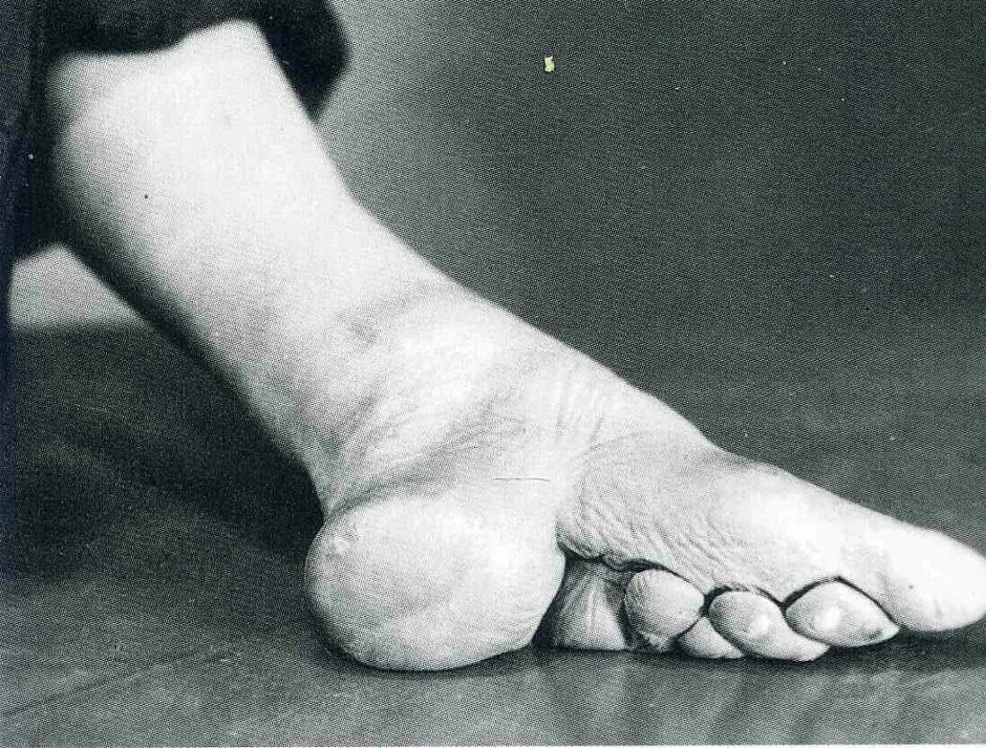 ножки китаянок в древнем китае