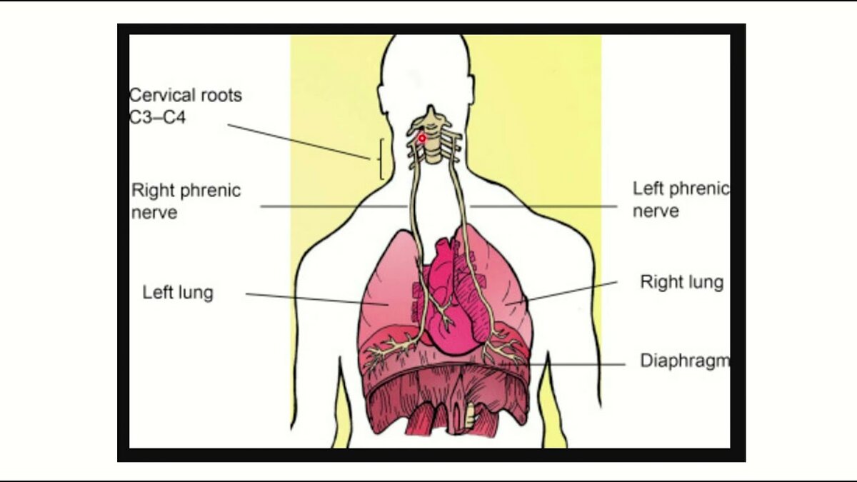 Диафрагмальные нервы: правый и левый (из свободного доступа)