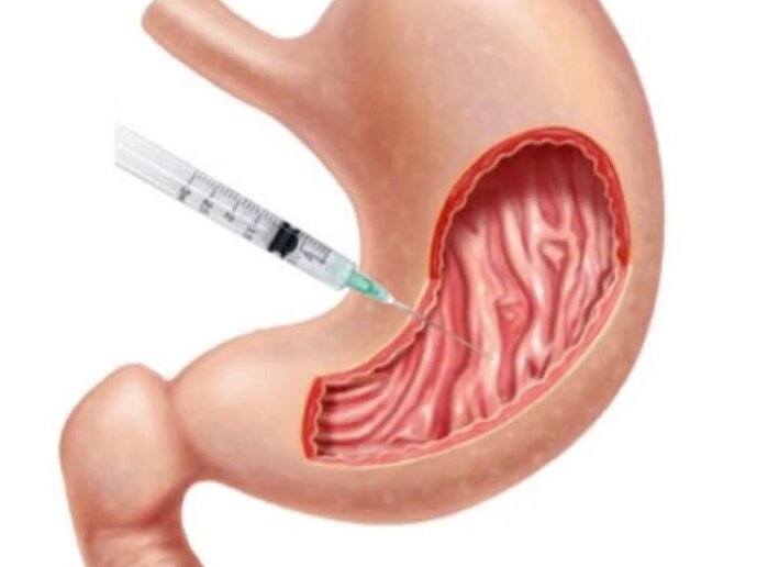 Источник: drgzaim.com