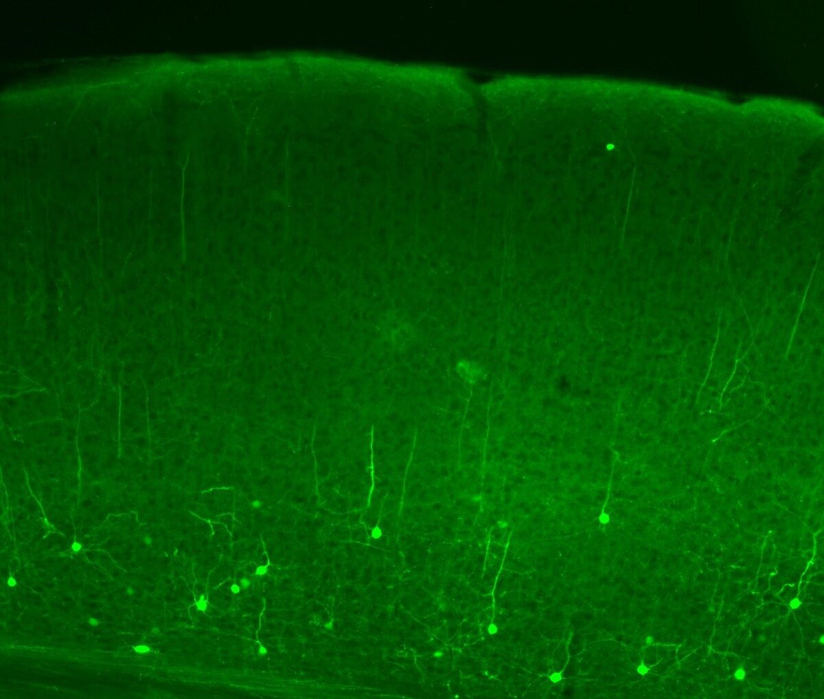 Срез зрительной коры мыши с нейронами, вырабатывающими светочувствительный белок канальный родопсин и зеленый флуоресцентный белок. Источник: Malyshev et al. / BBRC, 2023.