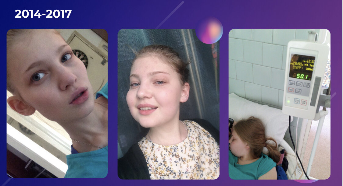 За эти 3 года я побывала и дефицитно худой, как анорекса…и от побочного эффекта таблеток худой, но с большими щеками, что мир ранее не зрел! 