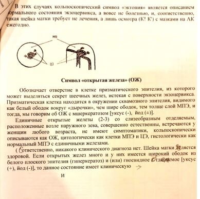 Зачем нужна кольпоскопия? – Медицинский центр «МедЛена»