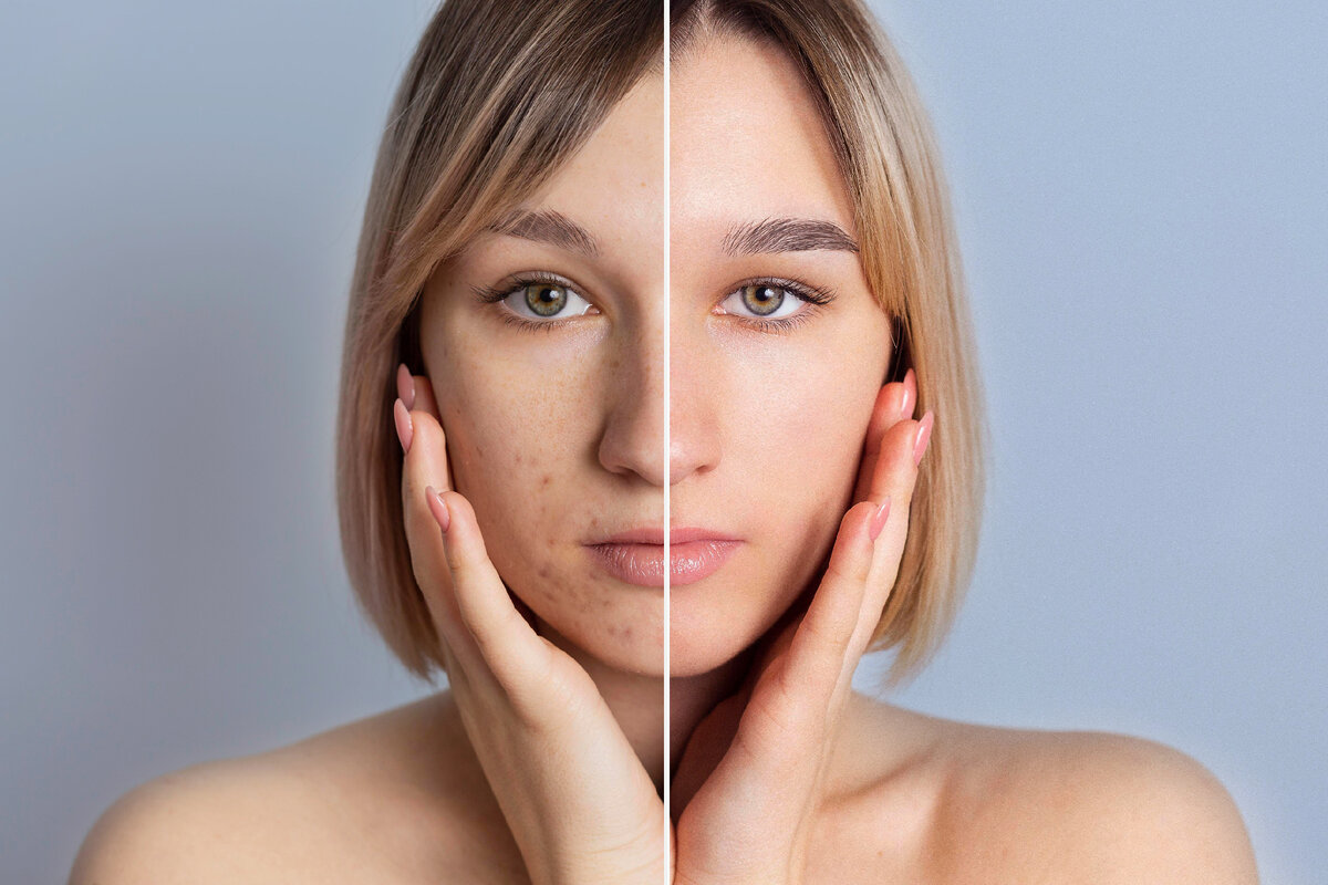 Изображение от <a href="https://ru.freepik.com/free-photo/before-and-after-portrait-of-woman-retouched_18962227.htm#&position=0&from_view=search&track=ais&uuid=cab6239c-28d6-4ef2-91ff-f0f20007657a">Freepik</a>
