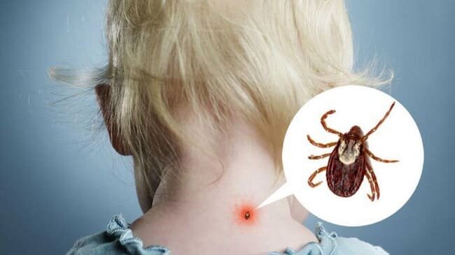 фото: med.oboz.ua