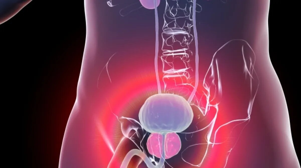 Эти 8 симптомов указывают на рак простаты – один из них проявляется только  ночью | Курьер.Среда | Дзен