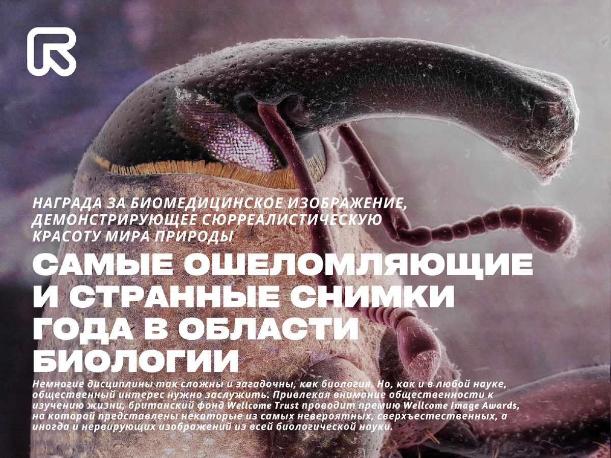Составное изображение головы коробчатого долгоносика (Anthonomus grandis), полученное с помощью сканирующего электронного микроскопа, найдено на крыльце пригородного дома. Коробчатый долгоносик - это жук, который питается хлопком и откладывает в него яйца. Эти сельскохозяйственные вредители имеют длинные изогнутые морды (часто вдвое длиннее их тела) и могут уничтожать целые посевы хлопка. Они развиваются из яйца во взрослую особь примерно за 20 дней и вырастают в среднем до 6-8 мм в длину. Это одно изображение из серии работ, посвященных обычным домашним вредителям, обнаруженным в домах на окраинах города. Эти изображения наших соседей по дому, которых часто упускают из виду, выполнены в стиле традиционных портретов.
