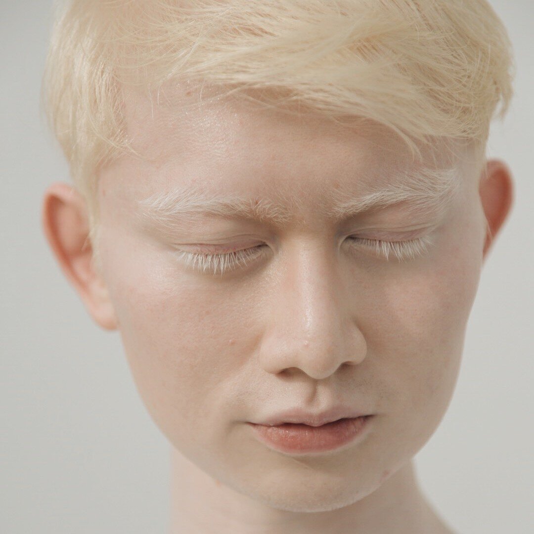Полный альбинос