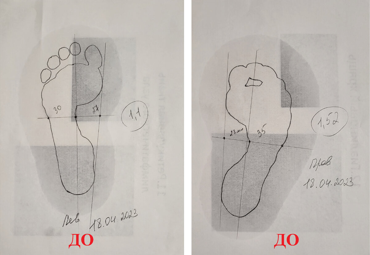 Такую картину мы наблюдали перед курсом массажа