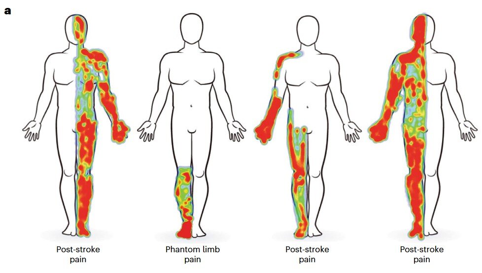   Prasad Shirvalkar et al. / Nature Neuroscience, 2023