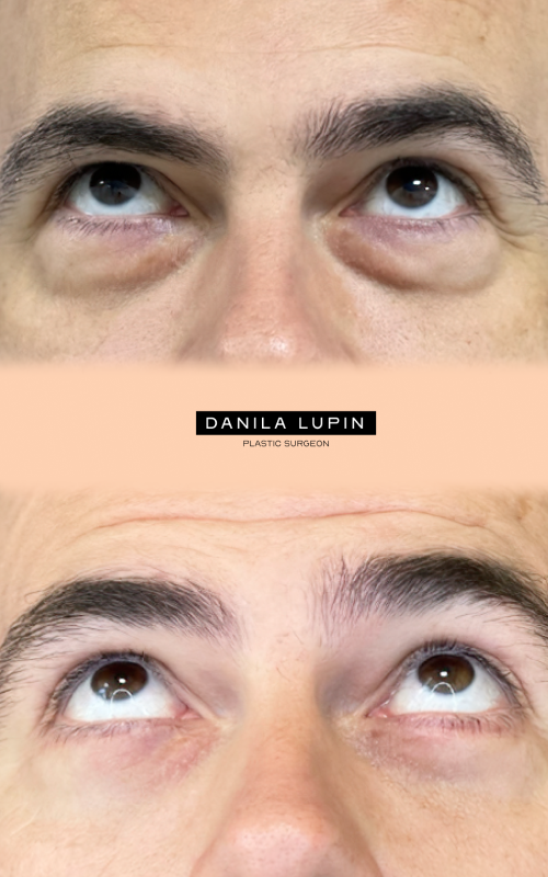 На фото пациент Данилы Лупина. Имеются противопоказания, необходима консультация специалиста.