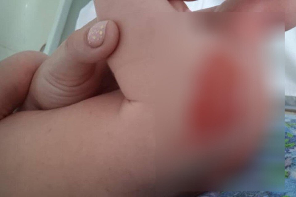     Через три дня младенца принесли матери, которая обнаружила на сыне то самое непонятное пятно. Фото: t.me/nikolaevskonamur  Социальные сети