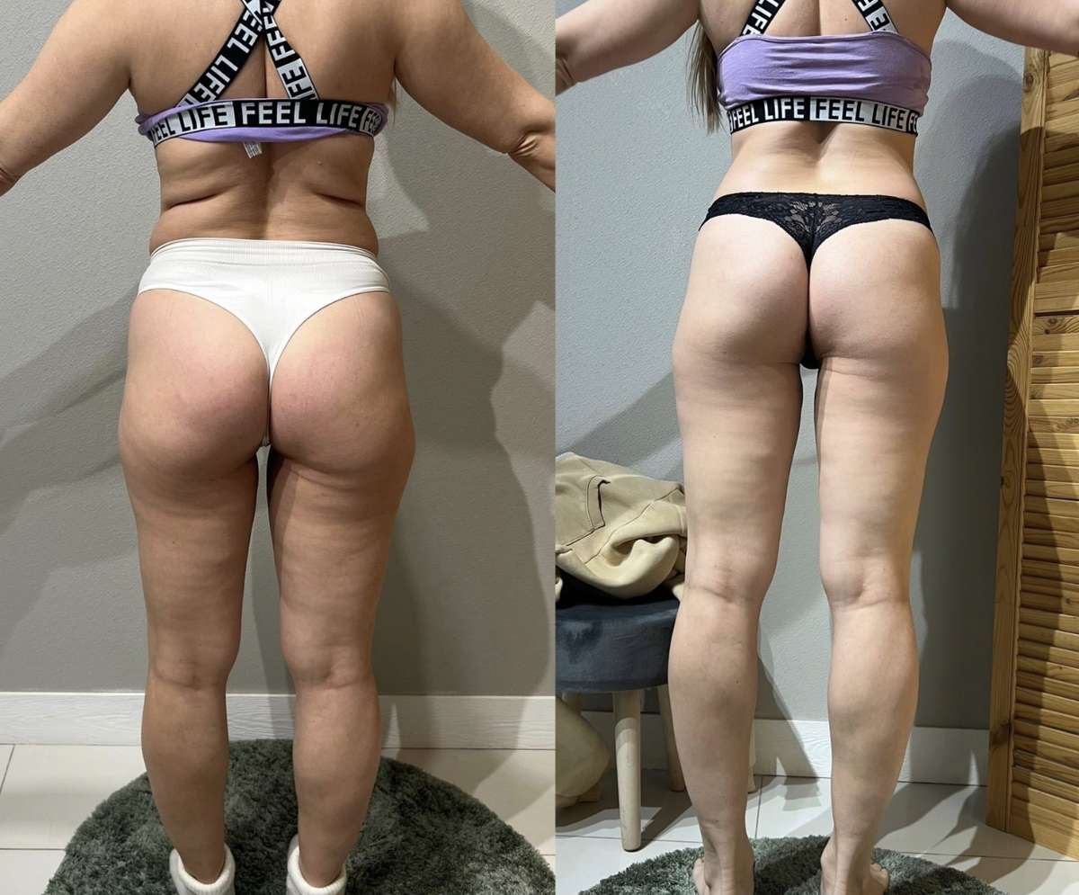 Больше результатов до/после на сайте https://vacuum38.ru/