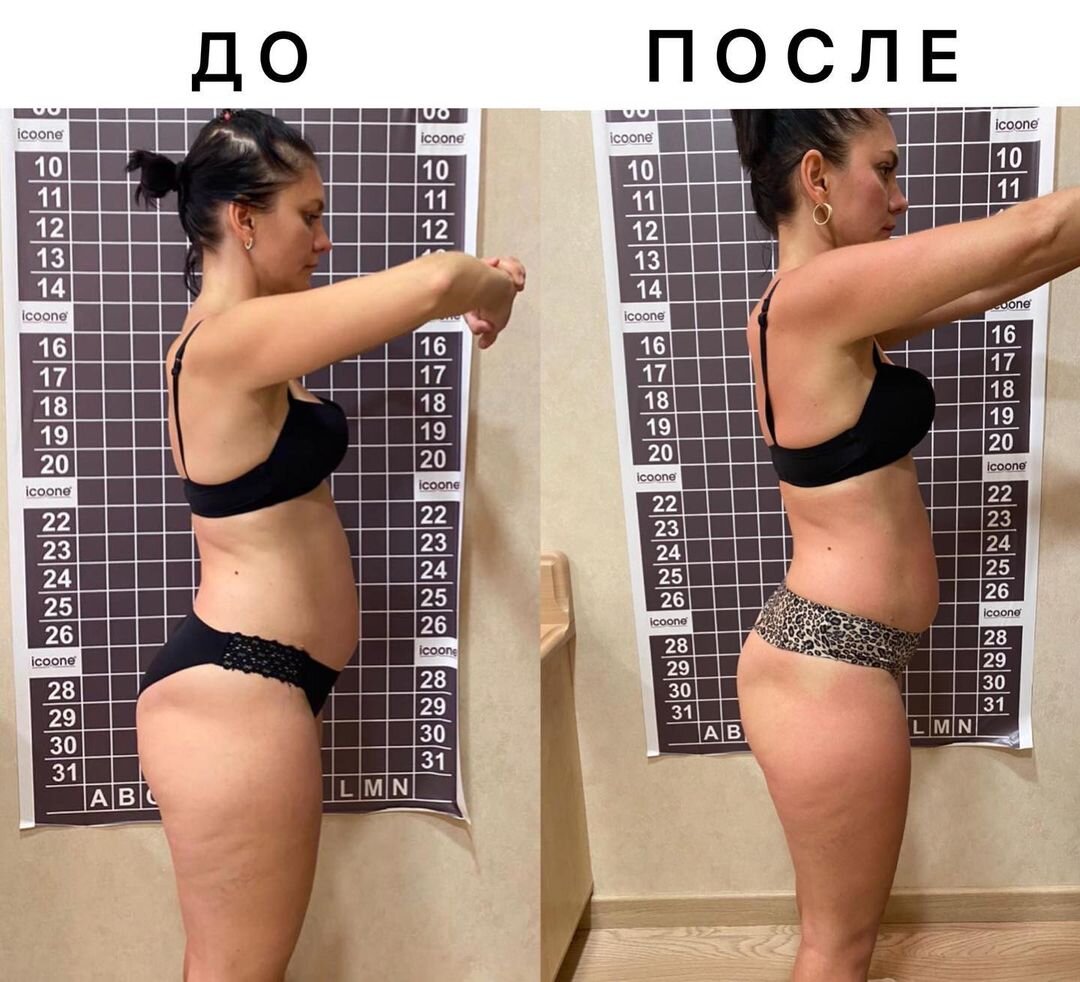  Наши замечательные участницы проекта "Преображение" всего за 8 процедур на аппарате BEAUTY LIZER изменили своё тело. Это фото - одной из них. 