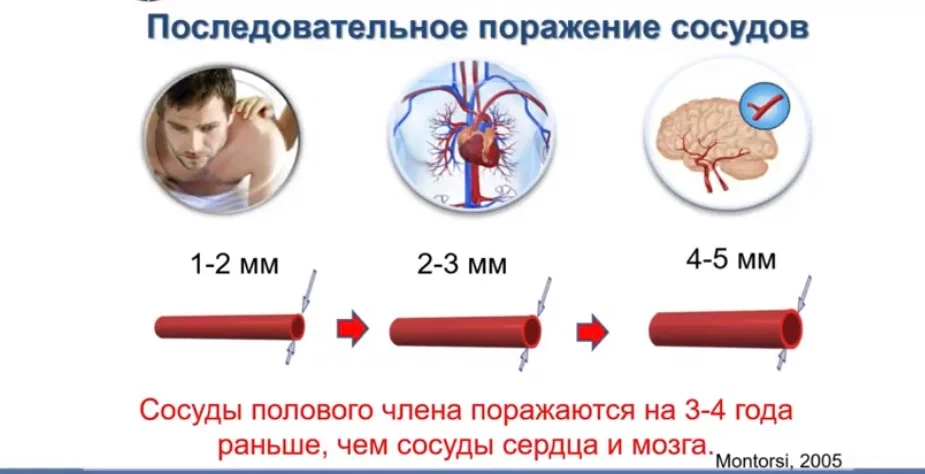 УЗИ полового органа у мужчин – когда нужно и что показывает? - Центр Семейной Медицины 