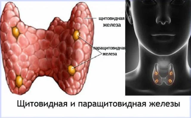 Опухоли паращитовидной железы