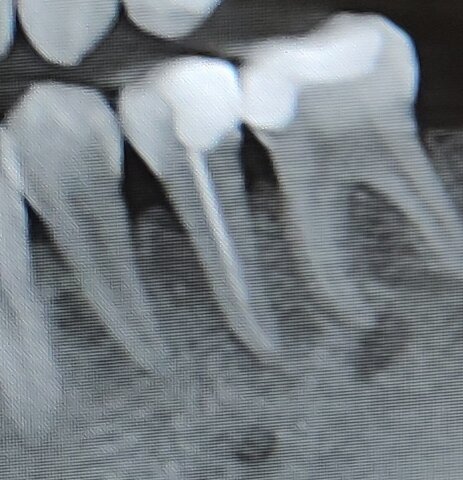 Фото автора. "Пятёрка и шестёрка"